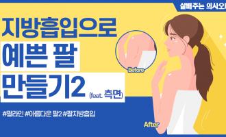 지방흡입으로 예쁜 팔 만들기 2 (feat. 측면)